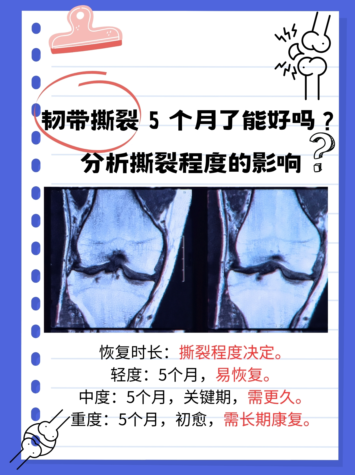 穆西亚拉腓骨骨折+韧带受伤预计伤缺4-5个月